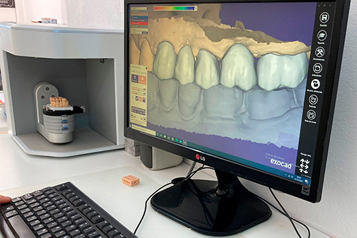 Diseño digital CAD del trabajo