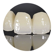 Provisionales de larga duración