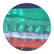 Férulas de descarga