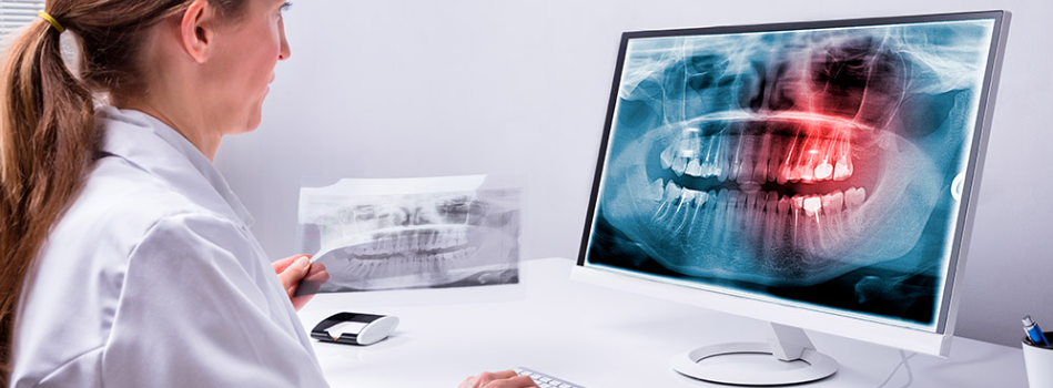 Ventaja 2 radiografia